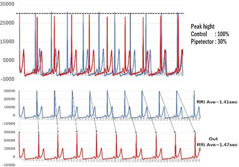 図3. NMRパイプテクターが心電図にもたらす変化